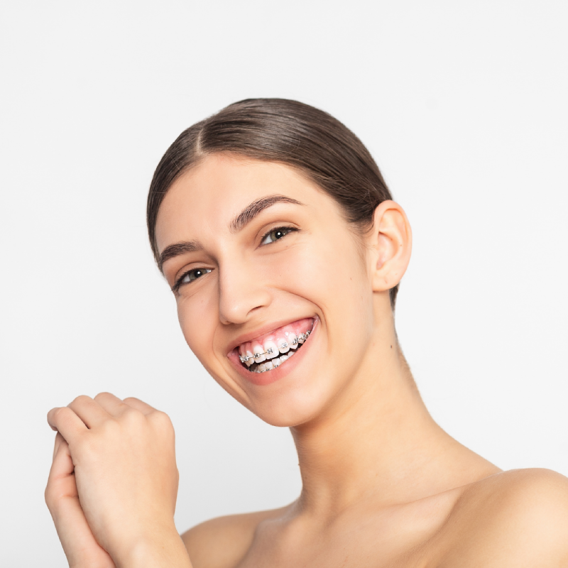 Fixed Braces Vs Clear Aligners - Your Local Beecroft Dentists At ...