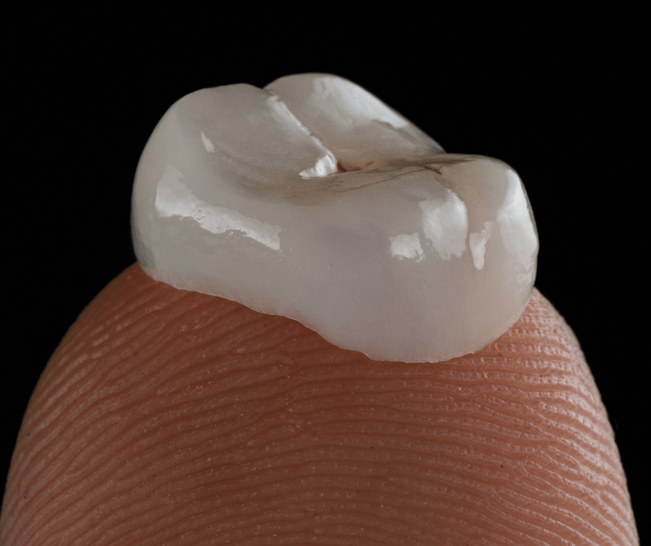 dental crown