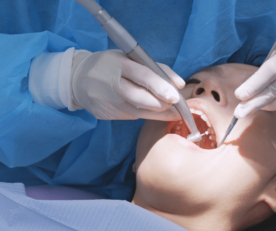 in-chair teeth whitening