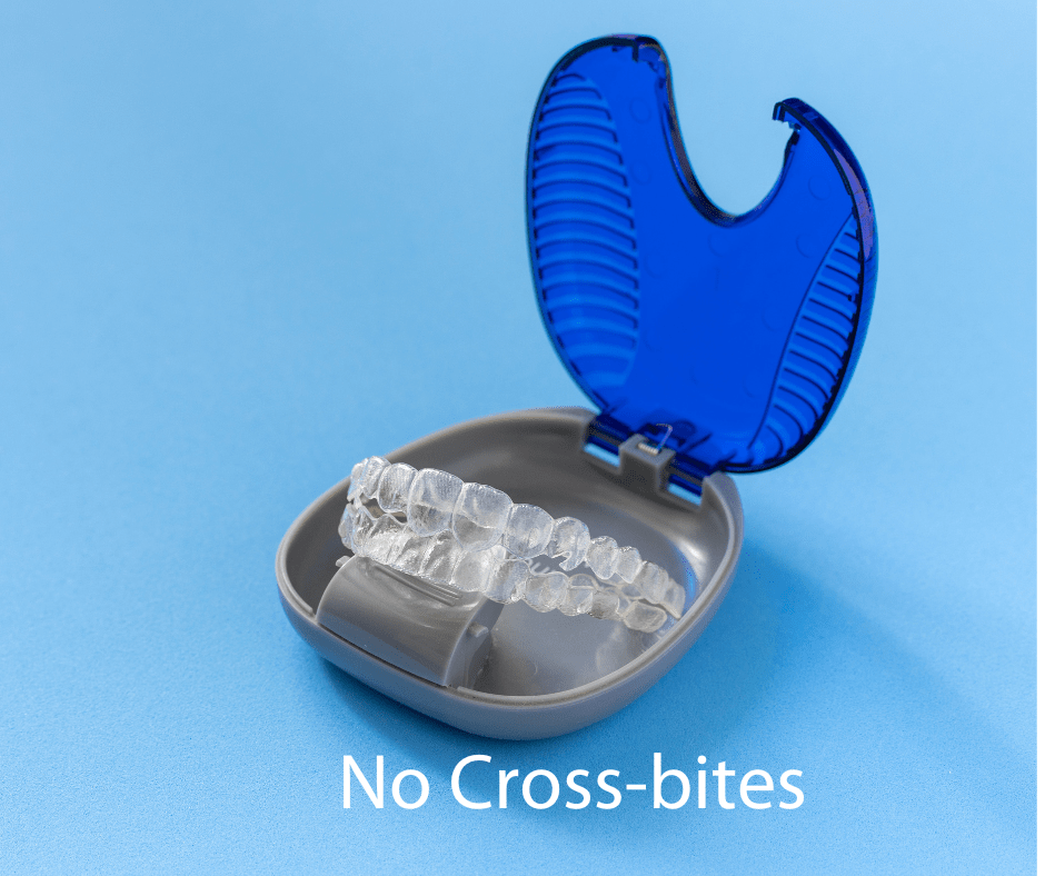 no cross bites