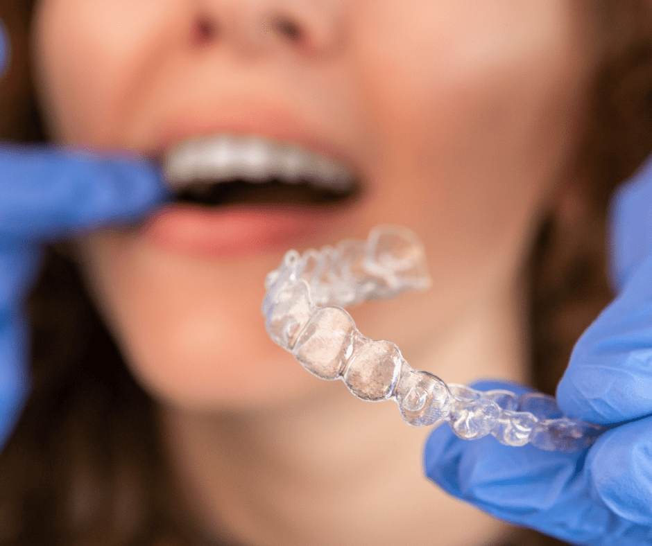 invisalign