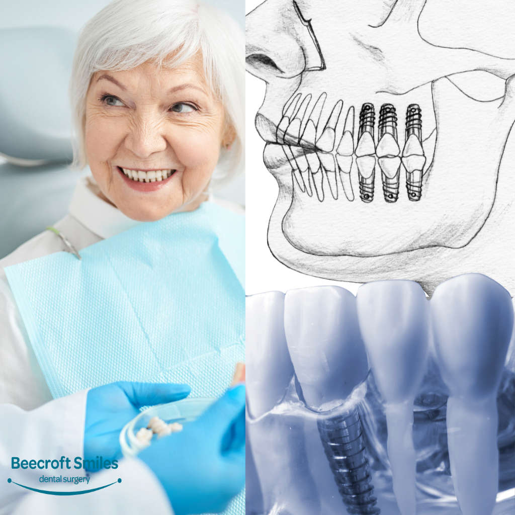 Dental Implants for Pensioners in Sydney1