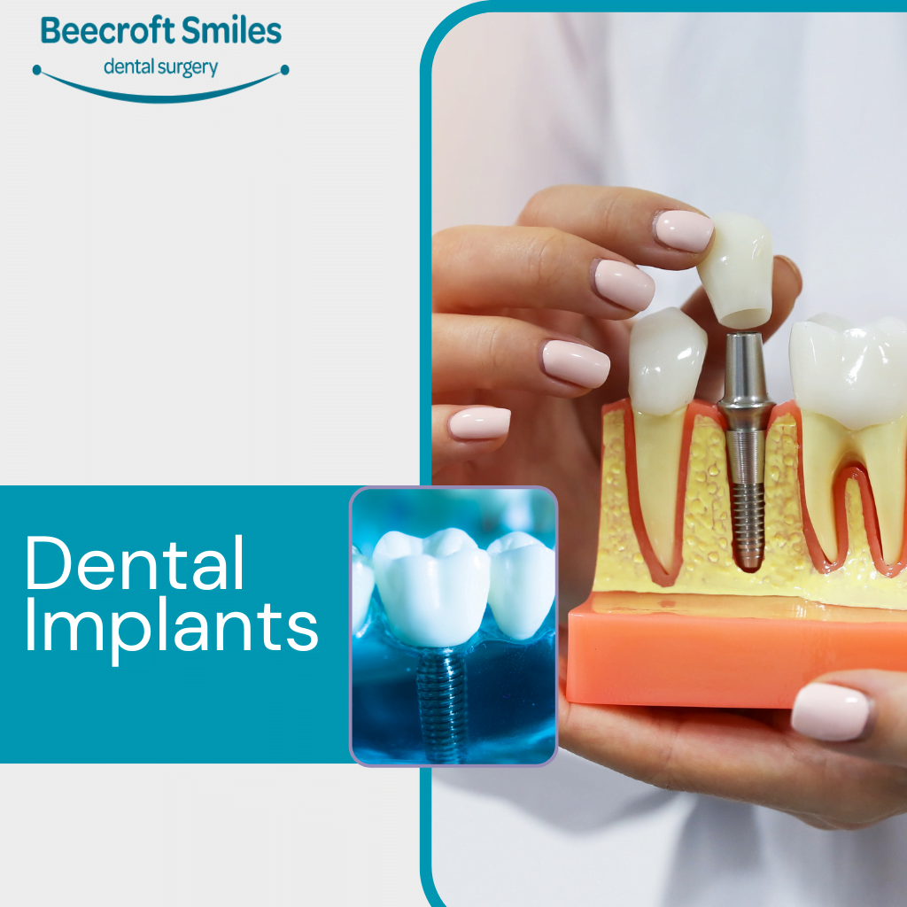 Top 10 Dental Implant Brands