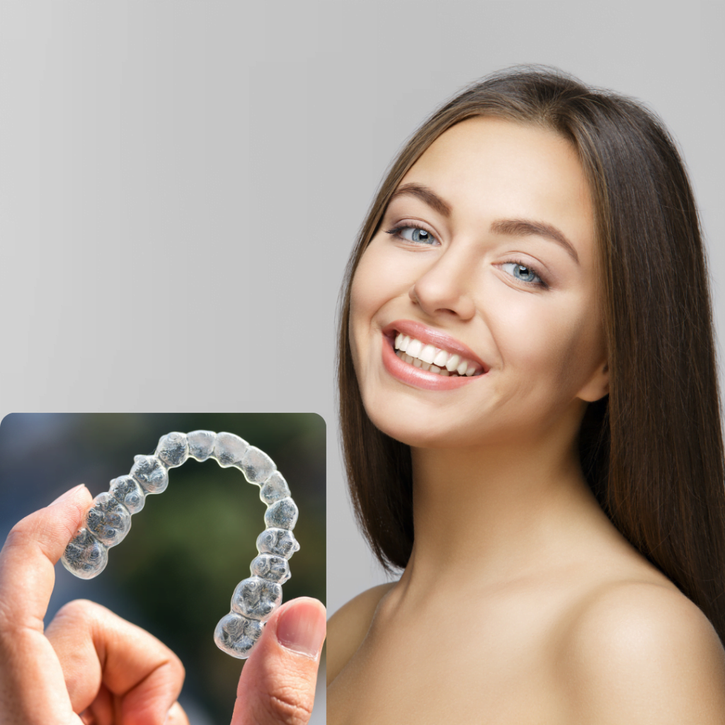 Invisalign Before and After smile