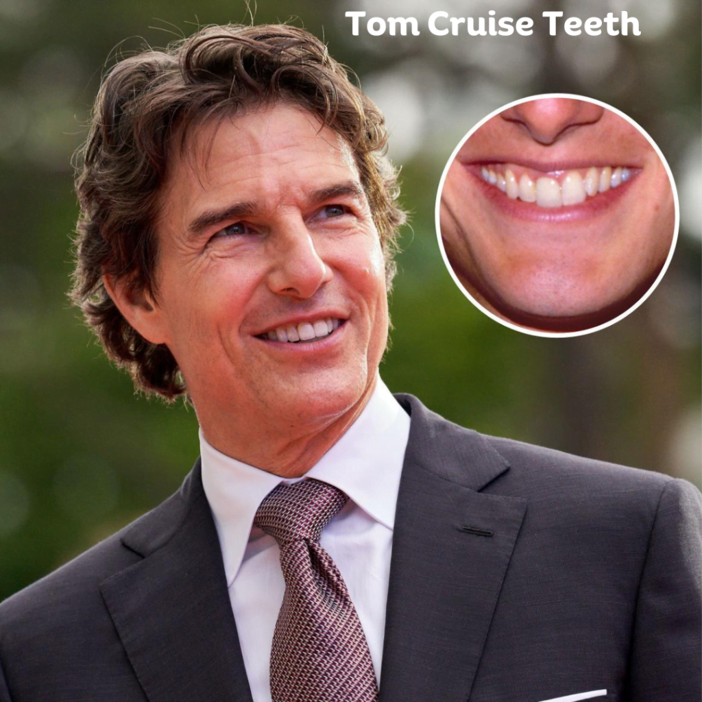 tom cruise teeth